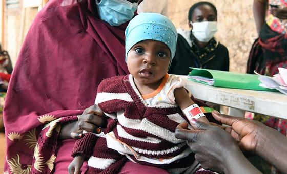 Se necesitan medidas urgentes para abordar de forma integral la desnutrición infantil en África Occidental y Central.